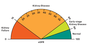How (in)accurate is eGFR?